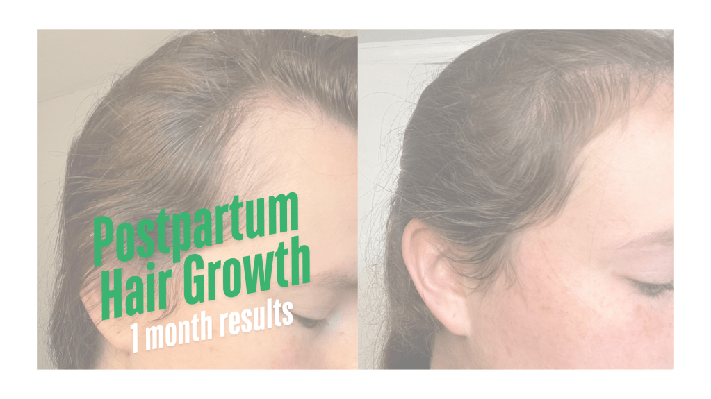 Postpartum Hair Growth&nbsp;Journey